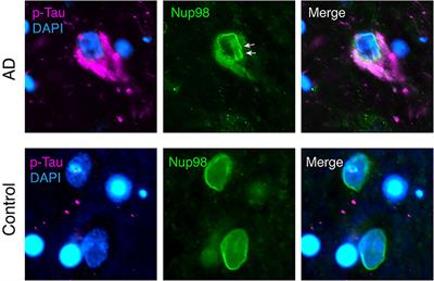 Nuclear Transport Deficits in Tau-Related Neurodegenerative Diseases